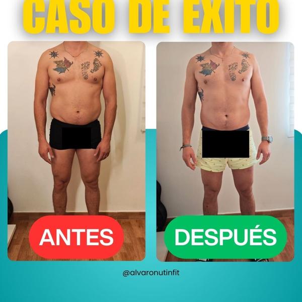 Antes y después de Elvis